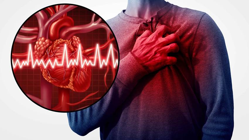 Conozca la combinación mortal que aumentan el riesgo de sufrir un infarto en pocos años