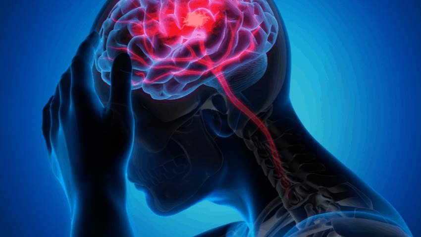 Se puede detener la epilepsia con un tratamiento temprano