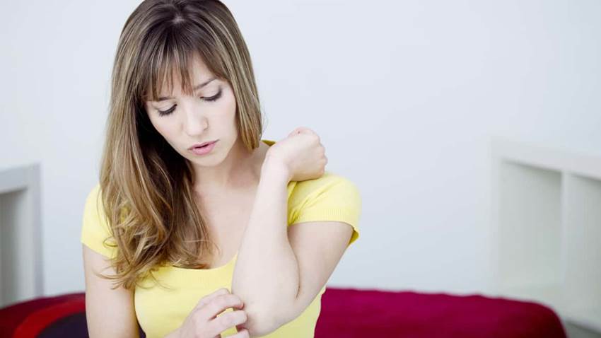 Psoriasis genital en mujeres