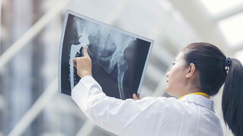 Las diez enfermedades más frecuentes  en los huesos