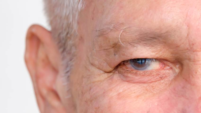 Estudio asegura que se puede detener células de envejecimiento para el desarrollo del glaucoma