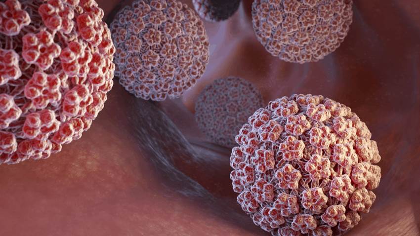 El virus del papiloma humano una infección que se puede adquirir incluso con preservativo