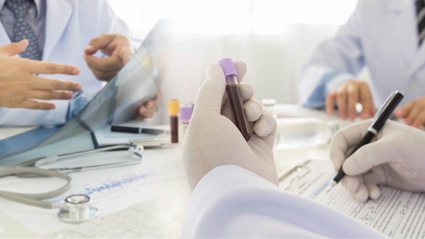 VIH podría provocar sintomatología neurológica en población femenina