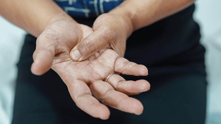 Tenosinovitis y su afectación en las manos