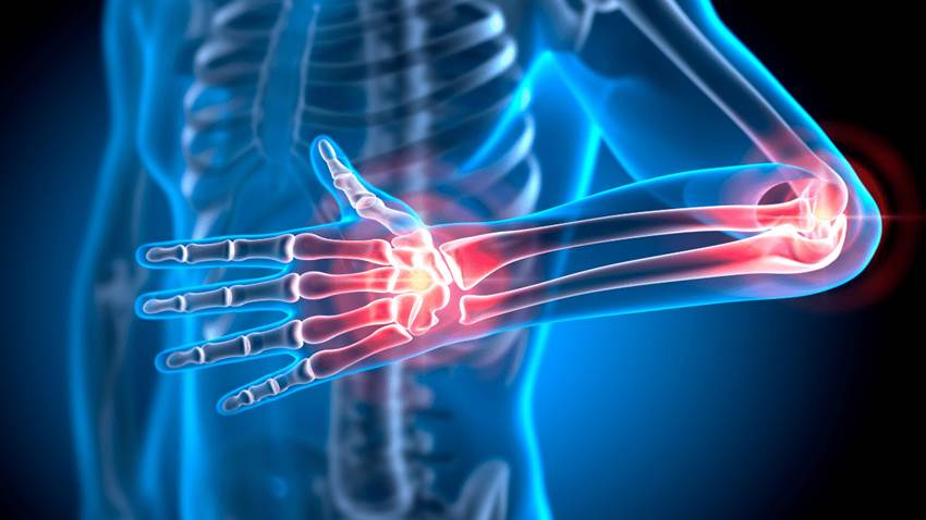 Los medicamentos biológicos continúan siendo el tratamiento reumatológico por elección