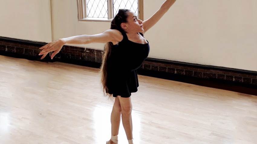 La impresionante historia de la bailarina que padece el síndrome Jarcho Levin