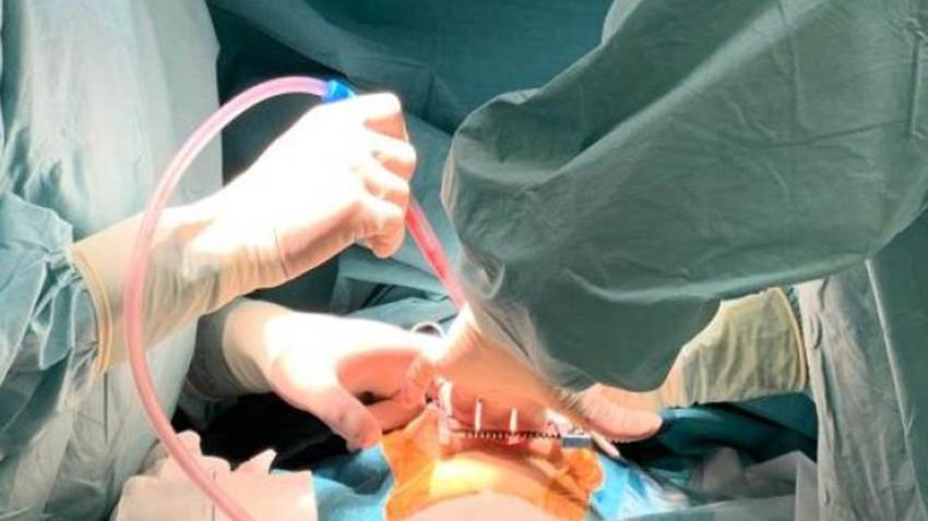 Trasplantan los dos pulmones a un bebé con una técnica pionera