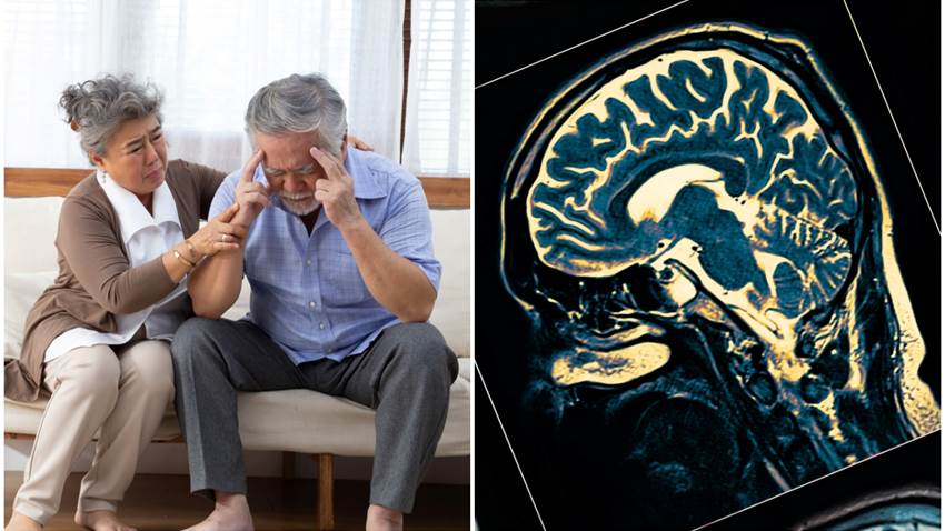Científicos descubrieron una nueva forma de detectar el Alzheimer: su efectividad es casi del 100%