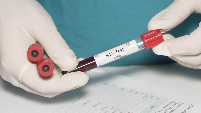 Vacuna contra el VIH en fase 3 tras muchos años de estudio