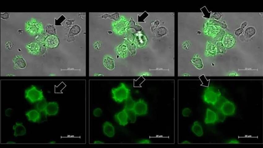 Mediante un beso células cancerígenas se abren camino frente a las defensas del cuerpo