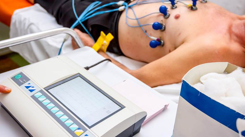 La hipertensión arterial podría causar la arritmia cardiaca más común